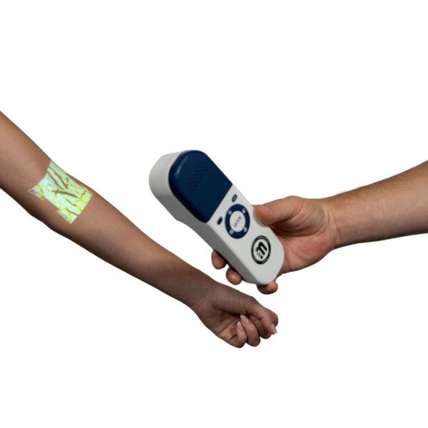 Φορητός Ανιχνευτής Φλεβών
